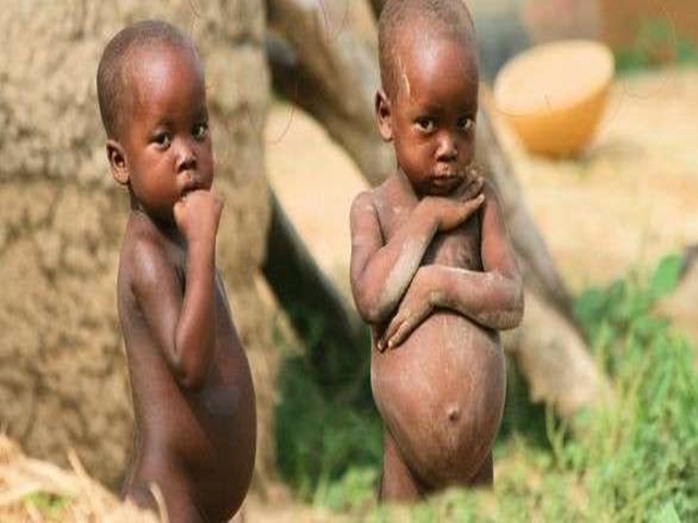 6 Prominent Signs of Malnutrition